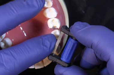 FitStrip-Subgingival-Finishing-Strips-from-Garrison-Dental-Solutions