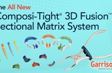 The-All-New-Composi-Tight-3D-Fusion-Sectional-Matrix-System