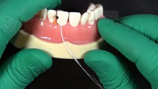 Use-this-floss-trick-to-seal-your-matrix-bands-for-anterior-restorations