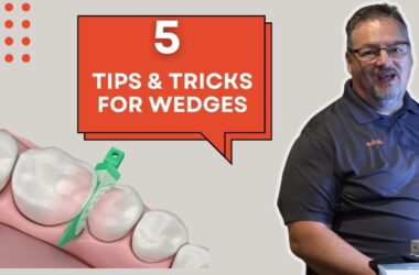 5-Wedge-Tips-amp-Tricks-for-Class-II-Composites