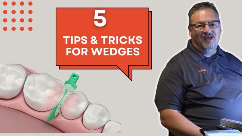 5-Wedge-Tips-amp-Tricks-for-Class-II-Composites