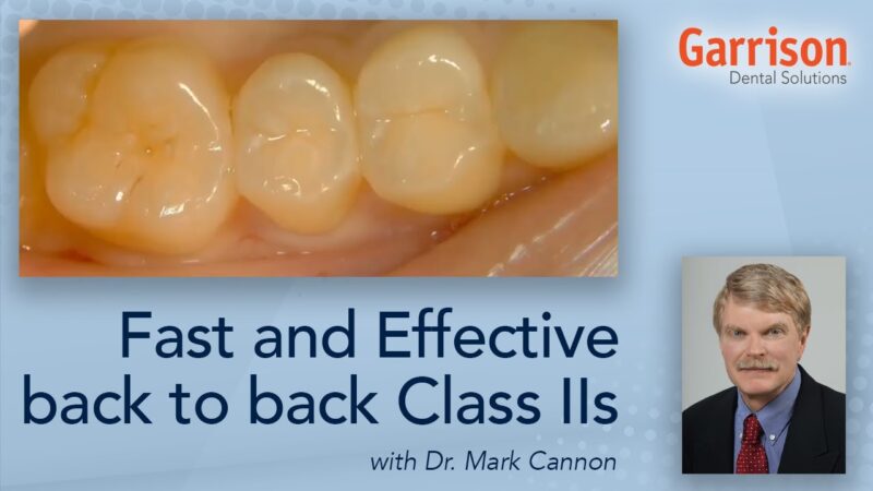 Fast-and-effective-back-to-back-Class-IIs-Featuring-Dr.-Mark-Cannon