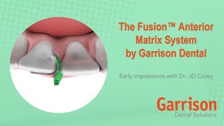 First-Impressions-of-the-NEW-Fusion-Anterior-Matrix-System-with-Dr.-JD-Corey