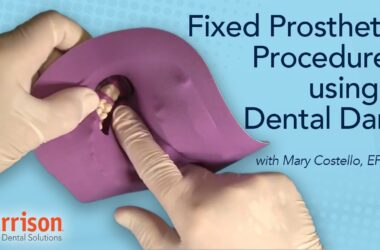 Fixed-Prosthetic-Procedures-Using-a-Dental-Dam-Mary-Costello-EFDA