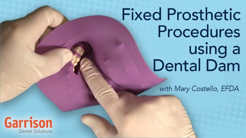 Fixed-Prosthetic-Procedures-Using-a-Dental-Dam-Mary-Costello-EFDA