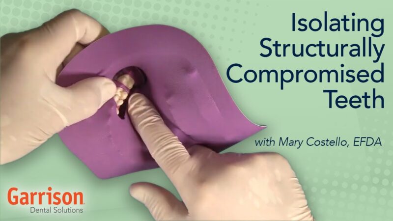 Isolating-Structurally-Compromised-Teeth-Mary-Costello-EFDA