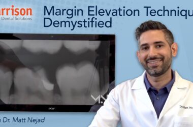 Margin-Elevation-Technique-Demystified-with-Dr-Matt-Nejad