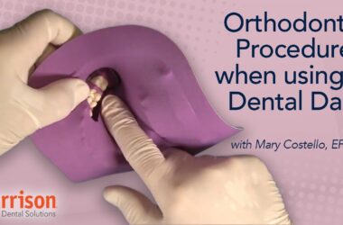 Orthodontic-Procedures-When-Using-a-Dental-Dam-Mary-Costello-EFDA