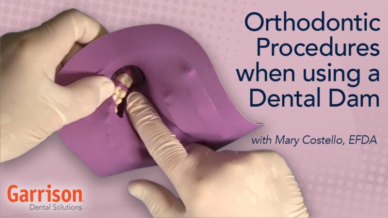 Orthodontic-Procedures-When-Using-a-Dental-Dam-Mary-Costello-EFDA