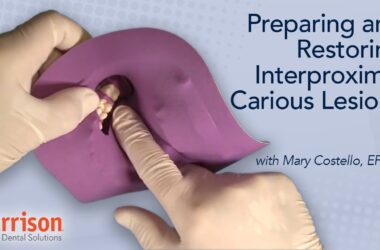 Preparing-and-Restoring-Interproximal-Carious-Lesions-Mary-Costello-EFDA