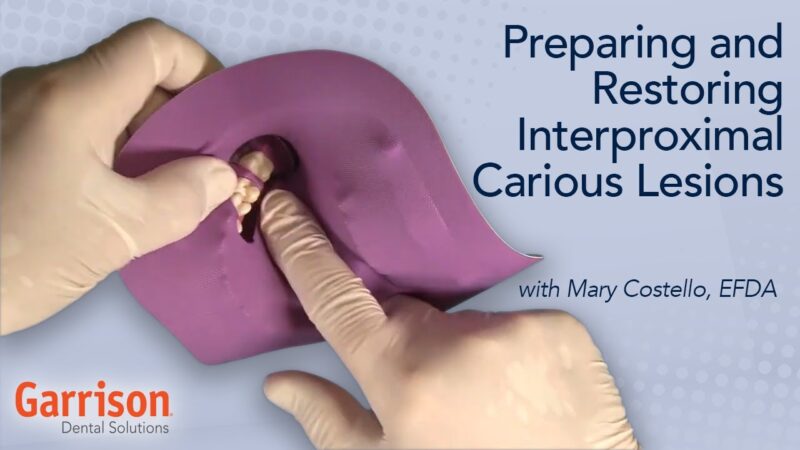 Preparing-and-Restoring-Interproximal-Carious-Lesions-Mary-Costello-EFDA