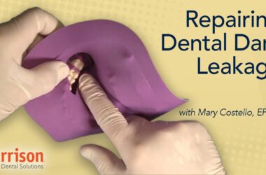 Repairing-Dental-Dam-Leakage-Mary-Costello-EFDA