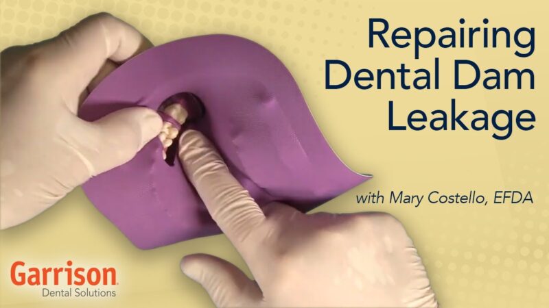 Repairing-Dental-Dam-Leakage-Mary-Costello-EFDA