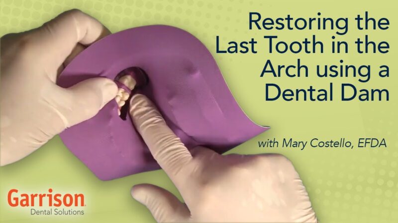 Restoring-the-Last-Tooth-in-the-Arch-Using-a-Dental-Dam-Mary-Costello-EFDA