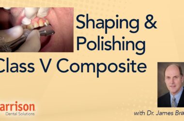 Shaping-and-Polishing-Class-V-Composite-Live-Case-with-Dr.-James-Braun