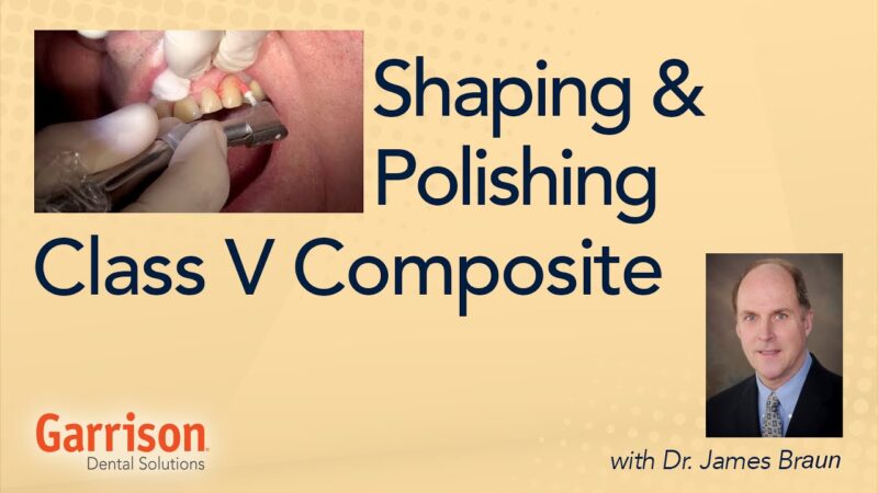 Shaping-and-Polishing-Class-V-Composite-Live-Case-with-Dr.-James-Braun